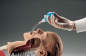 Preview: Ambu TubeChek B, Ballon